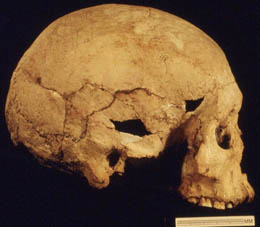 keilor lateral